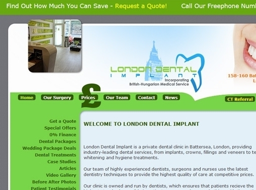 https://www.london-dental-implant.co.uk/ website